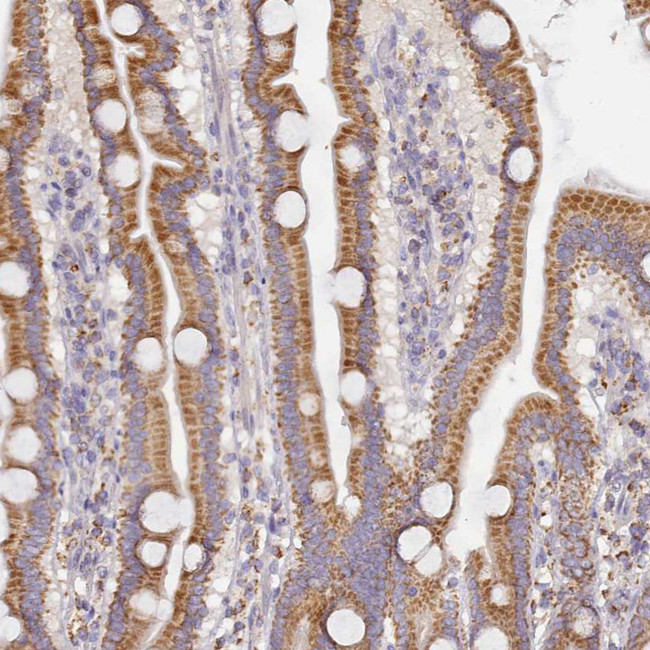 ACSS1 Antibody in Immunohistochemistry (Paraffin) (IHC (P))