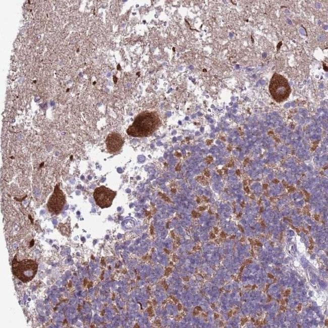 Hippocalcin Antibody in Immunohistochemistry (IHC)