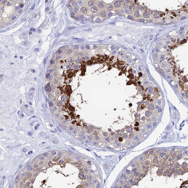 HSP701L Antibody in Immunohistochemistry (Paraffin) (IHC (P))