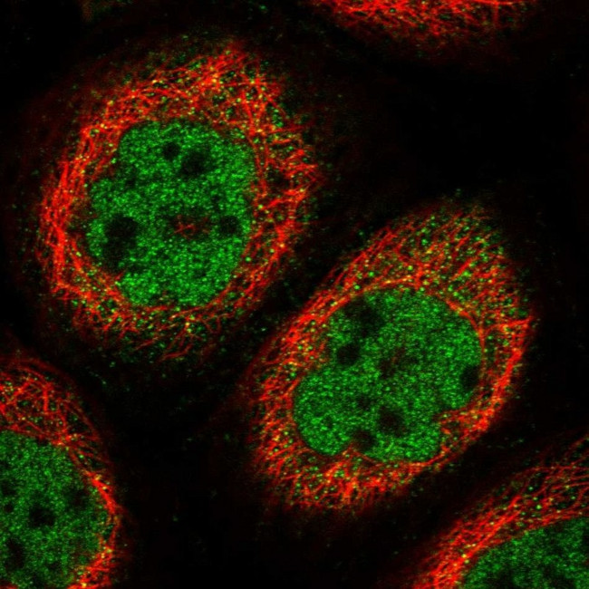 CABIN1 Antibody in Immunocytochemistry (ICC/IF)