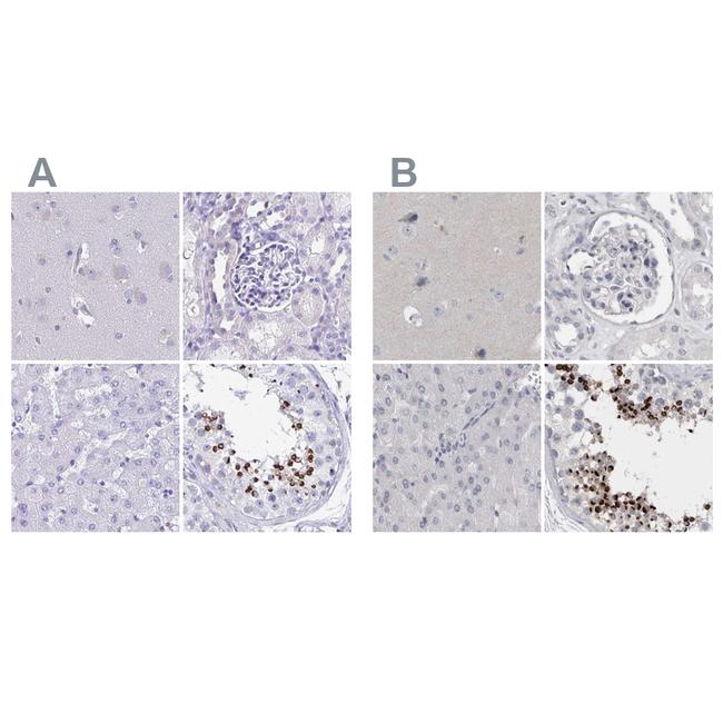 SPACA1 Antibody in Immunohistochemistry (IHC)