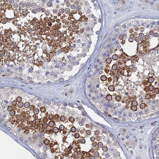 MTRF1 Antibody in Immunohistochemistry (Paraffin) (IHC (P))