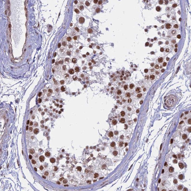 ALG10 Antibody in Immunohistochemistry (Paraffin) (IHC (P))