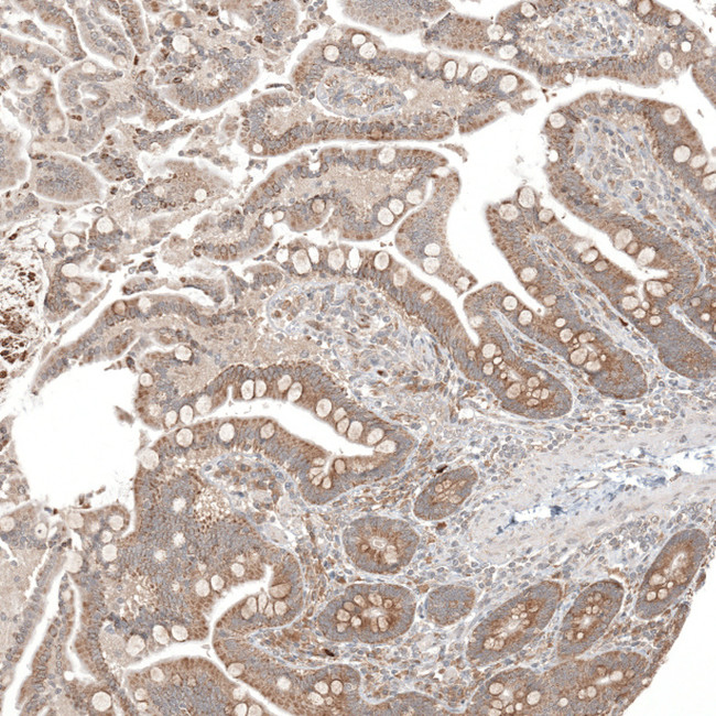 CPNE7 Antibody in Immunohistochemistry (Paraffin) (IHC (P))