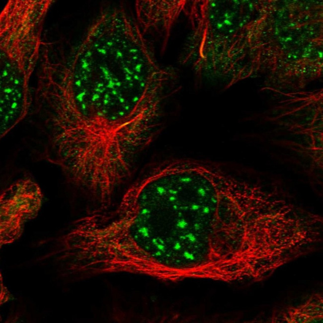 ZNF584 Antibody in Immunocytochemistry (ICC/IF)