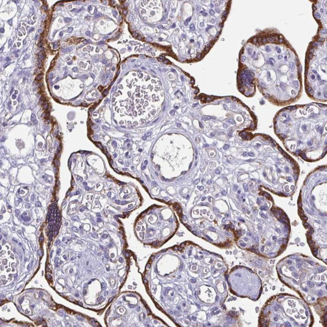 ADAMTS6 Antibody in Immunohistochemistry (Paraffin) (IHC (P))