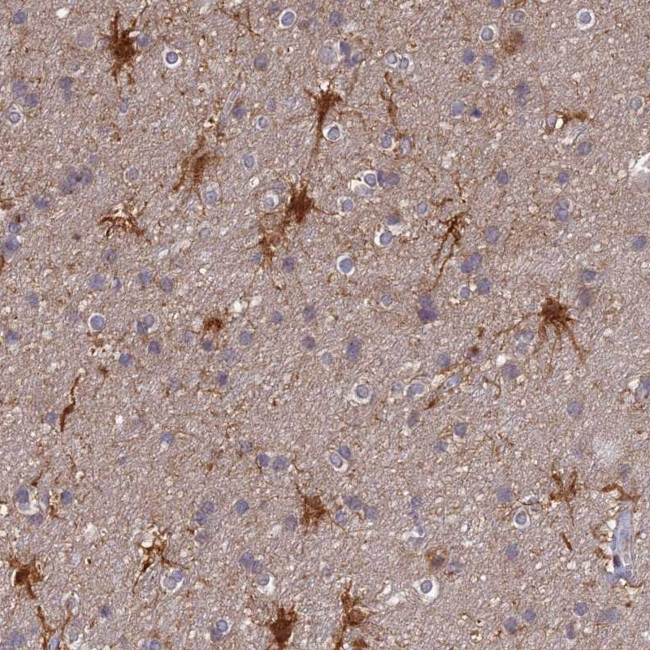 ELOA2 Antibody in Immunohistochemistry (Paraffin) (IHC (P))