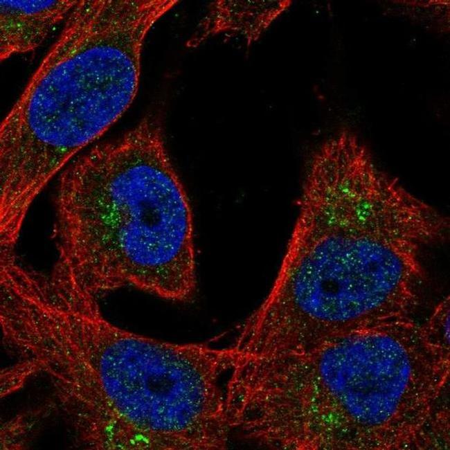 LGI4 Antibody in Immunocytochemistry (ICC/IF)