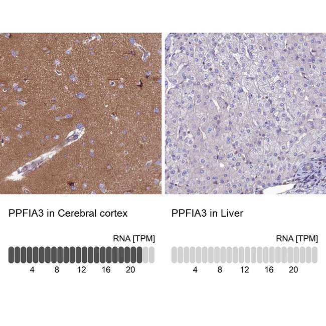 PPFIA3 Antibody in Immunohistochemistry (IHC)