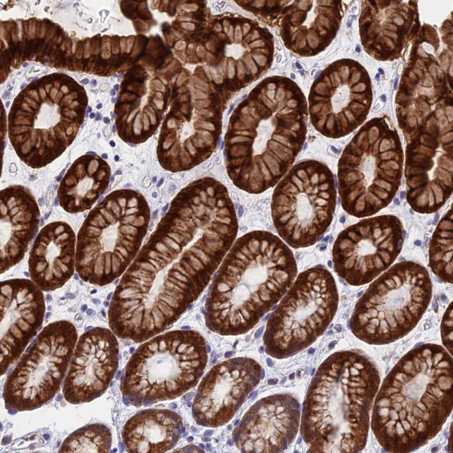 ZNF181 Antibody in Immunohistochemistry (Paraffin) (IHC (P))