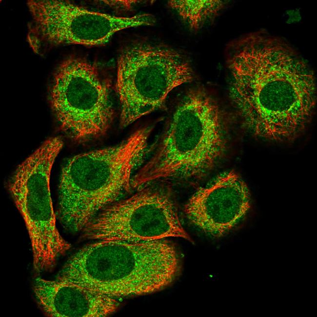 PADI3 Antibody in Immunocytochemistry (ICC/IF)