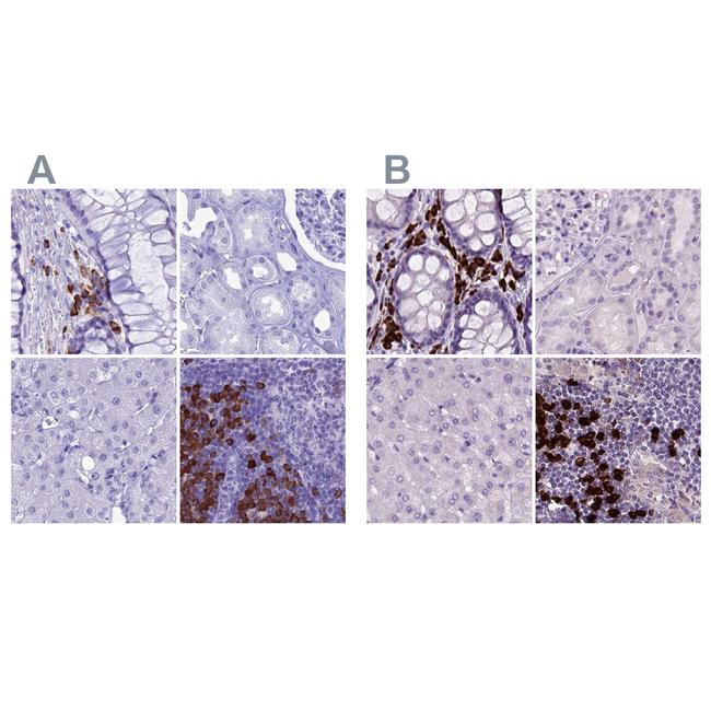 MZB1 Antibody in Immunohistochemistry (IHC)