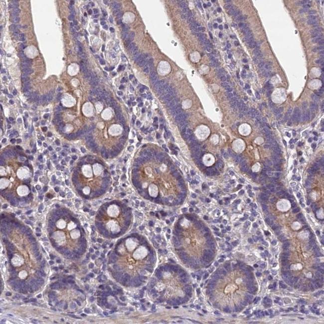 NT5M Antibody in Immunohistochemistry (IHC)