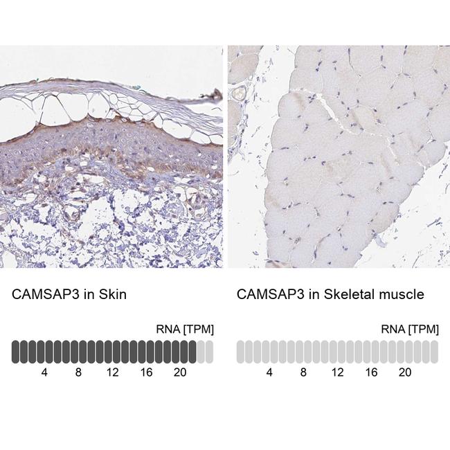 CAMSAP3 Antibody in Immunohistochemistry (IHC)