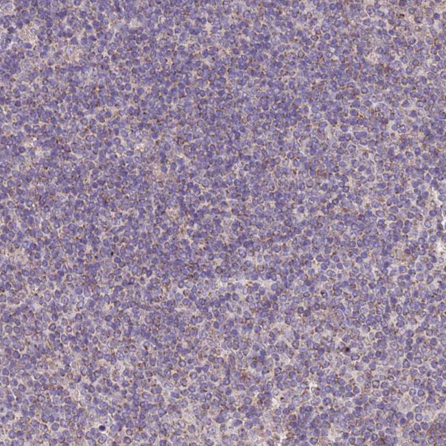 ACAD8 Antibody in Immunohistochemistry (Paraffin) (IHC (P))