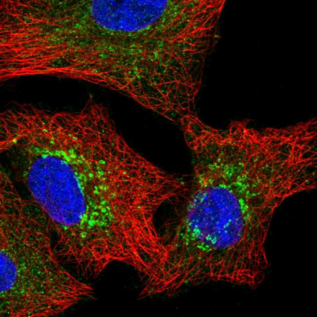 Pyruvate Carboxylase Antibody in Immunocytochemistry (ICC/IF)