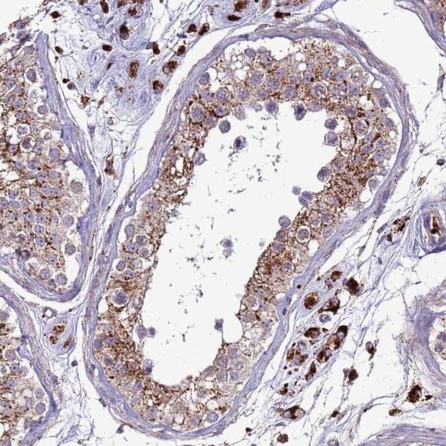 VPS36 Antibody in Immunohistochemistry (IHC)