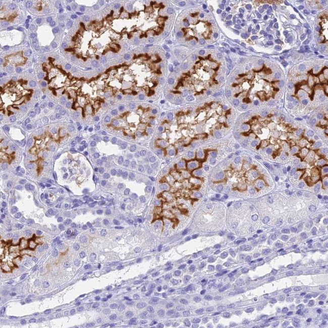 SLC36A2 Antibody in Immunohistochemistry (Paraffin) (IHC (P))