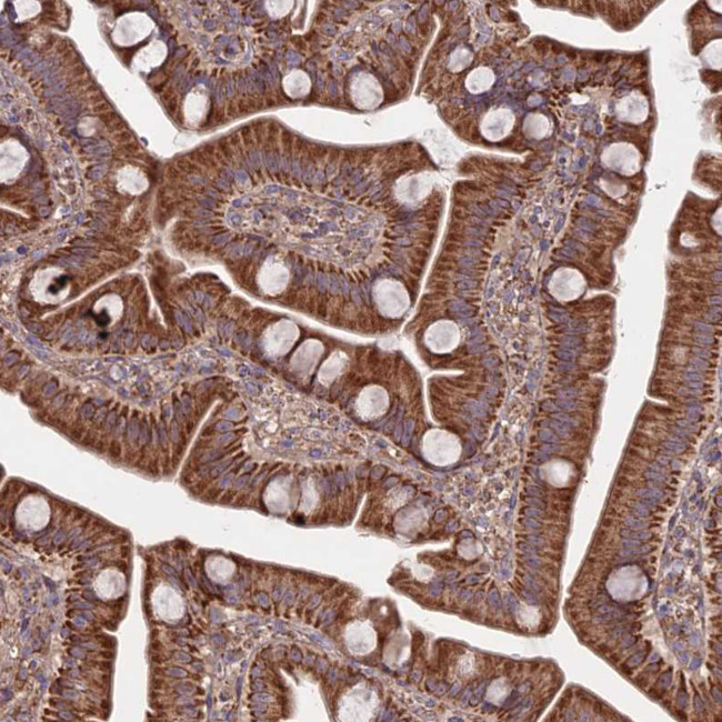 COX11 Antibody in Immunohistochemistry (Paraffin) (IHC (P))