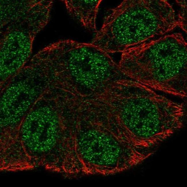 SRGAP3 Antibody in Immunocytochemistry (ICC/IF)