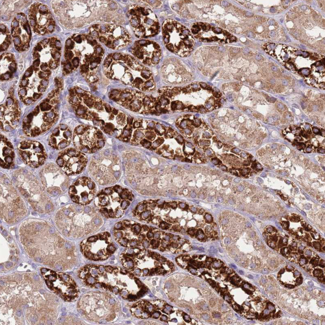 FECH Antibody in Immunohistochemistry (Paraffin) (IHC (P))