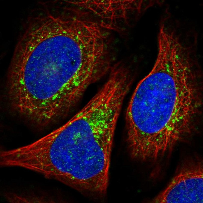 VTI1B Antibody in Immunocytochemistry (ICC/IF)