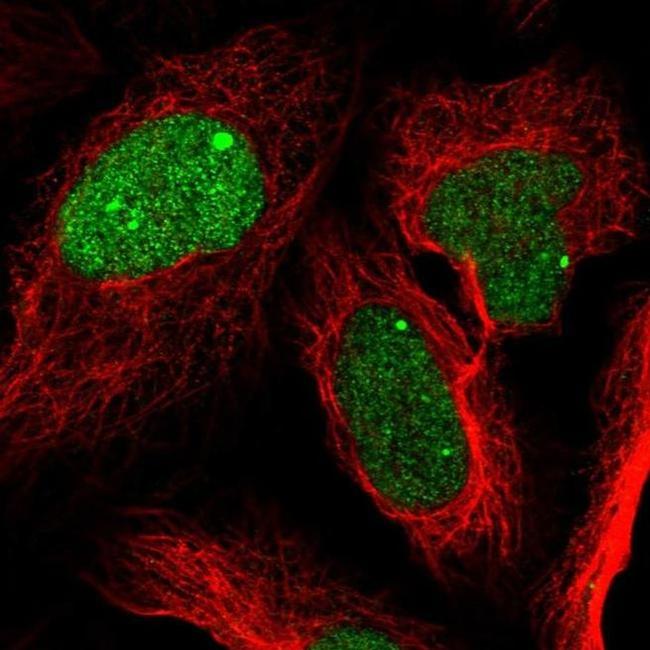 ZNF565 Antibody in Immunocytochemistry (ICC/IF)