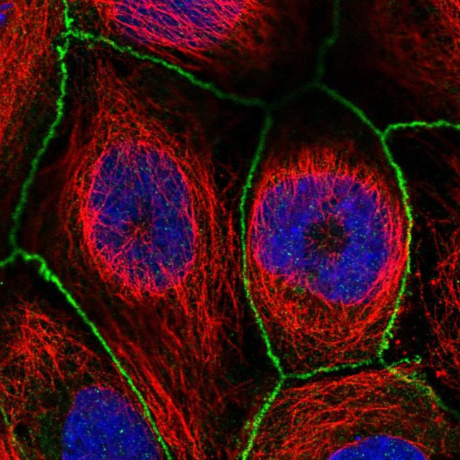 WDPCP Antibody in Immunocytochemistry (ICC/IF)