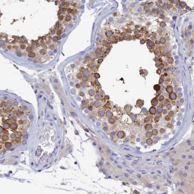 WDR35 Antibody in Immunohistochemistry (Paraffin) (IHC (P))