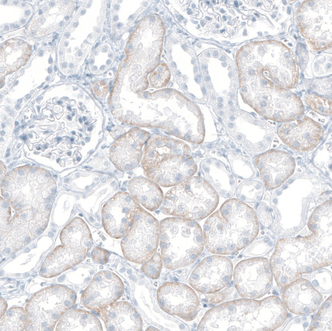 SLC22A8 Antibody in Immunohistochemistry (Paraffin) (IHC (P))