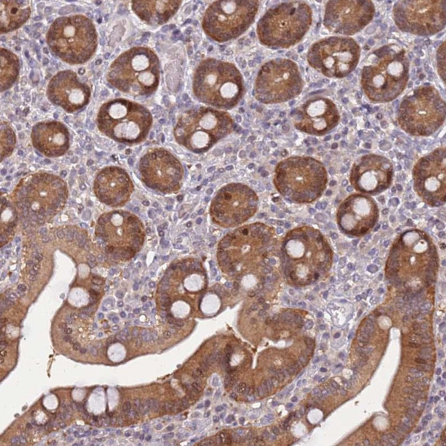 GEF5 Antibody in Immunohistochemistry (Paraffin) (IHC (P))