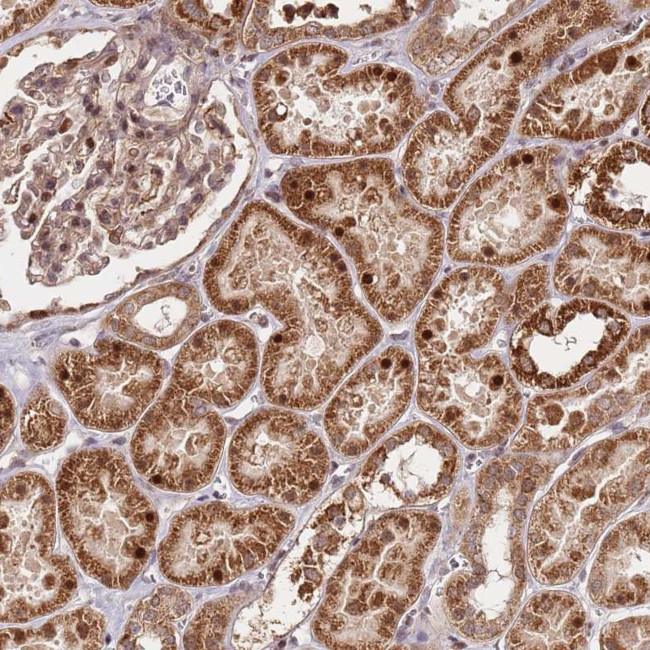 EDC3 Antibody in Immunohistochemistry (Paraffin) (IHC (P))