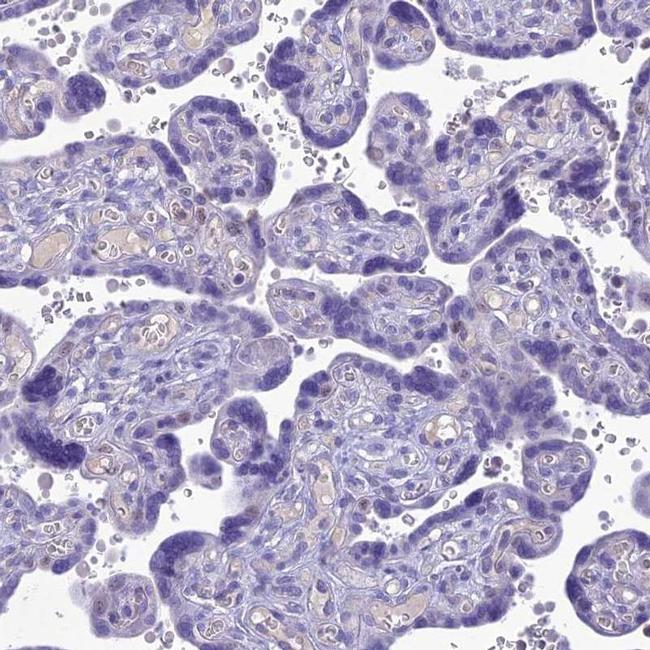 SLC13A5 Antibody in Immunohistochemistry (IHC)