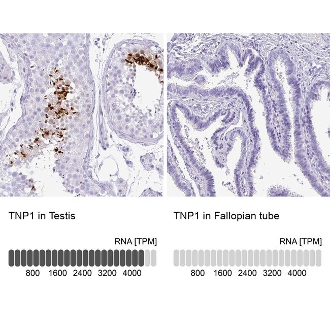 TNP1 Antibody in Immunohistochemistry (IHC)