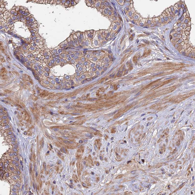 EXT1 Antibody in Immunohistochemistry (Paraffin) (IHC (P))