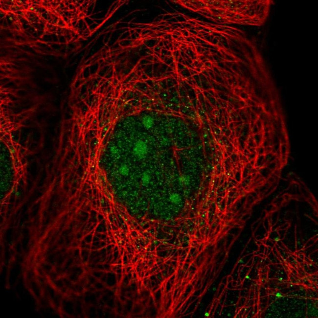 UTP23 Antibody in Immunocytochemistry (ICC/IF)