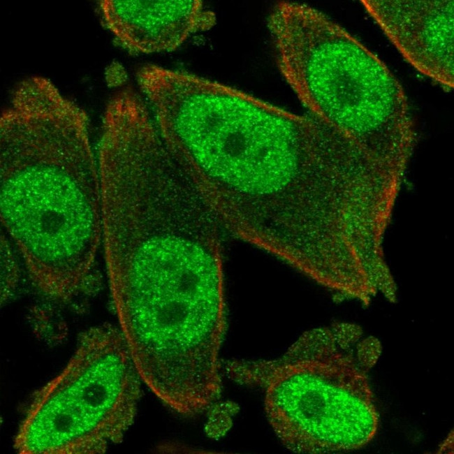 MYST2 Antibody in Immunocytochemistry (ICC/IF)