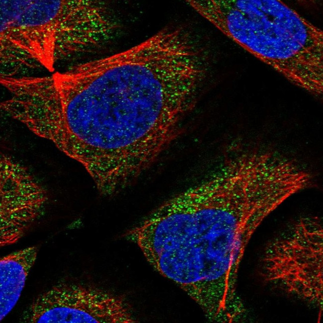 CNOT6 Antibody in Immunocytochemistry (ICC/IF)