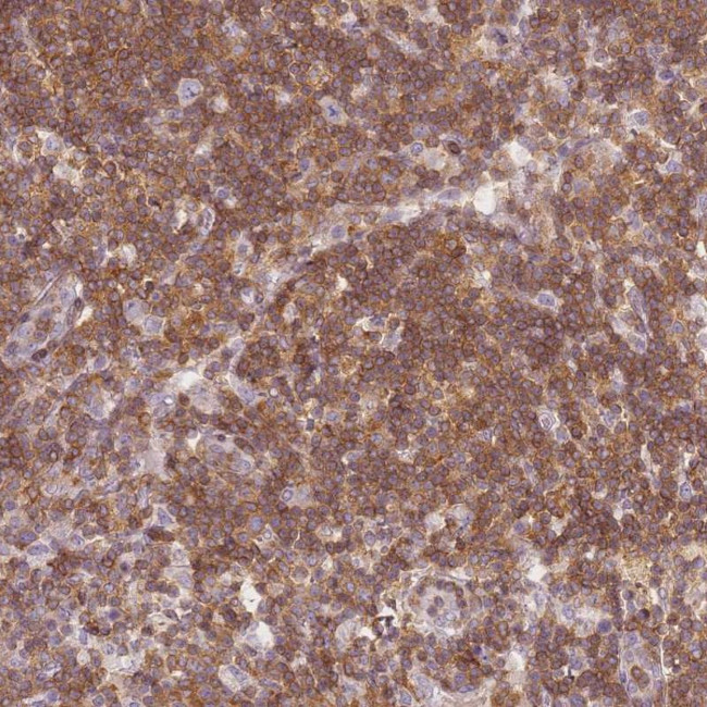 JAKMIP1 Antibody in Immunohistochemistry (Paraffin) (IHC (P))