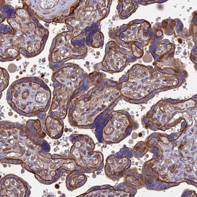 HPa2 Antibody in Immunohistochemistry (Paraffin) (IHC (P))