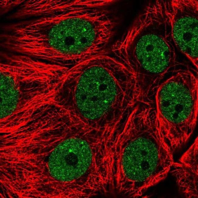 ENOPH1 Antibody in Immunocytochemistry (ICC/IF)