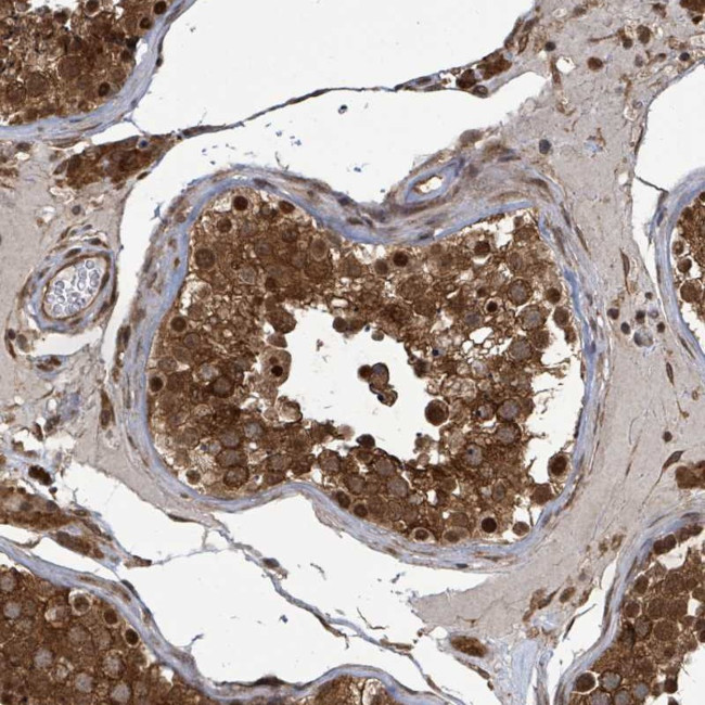 KLC1 Antibody in Immunohistochemistry (Paraffin) (IHC (P))