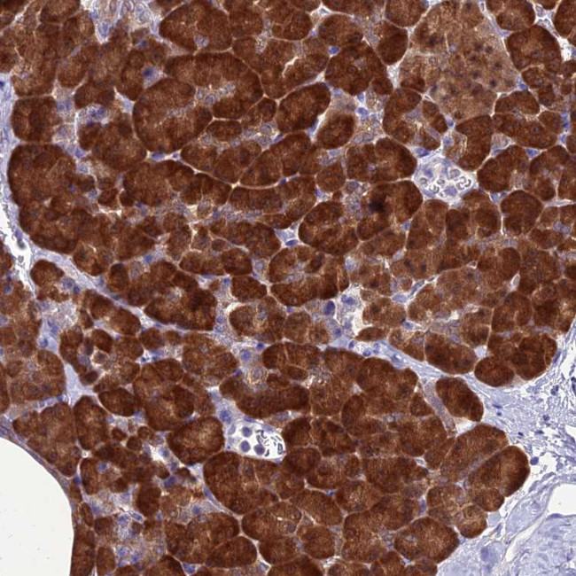 GNPNAT1 Antibody in Immunohistochemistry (Paraffin) (IHC (P))