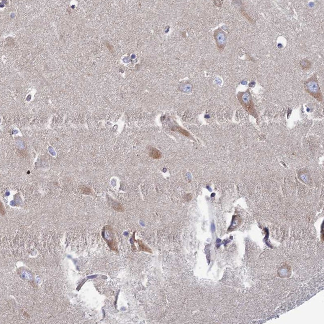 CLCN3 Antibody in Immunohistochemistry (Paraffin) (IHC (P))