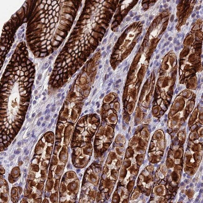 PUS10 Antibody in Immunohistochemistry (IHC)