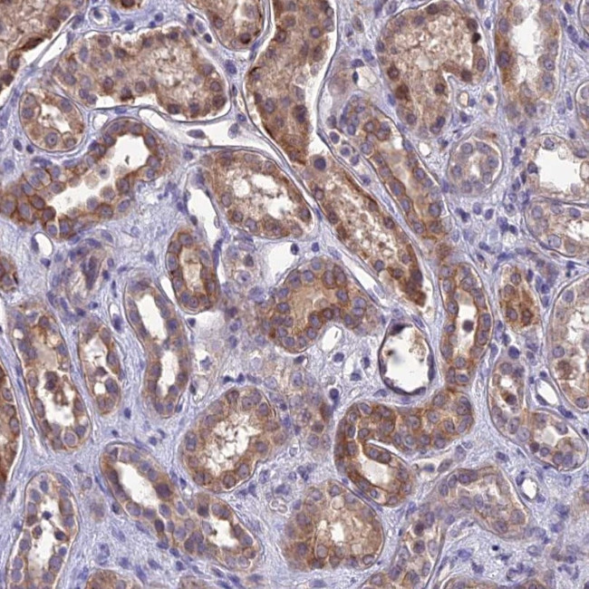 DMRTA1 Antibody in Immunohistochemistry (Paraffin) (IHC (P))