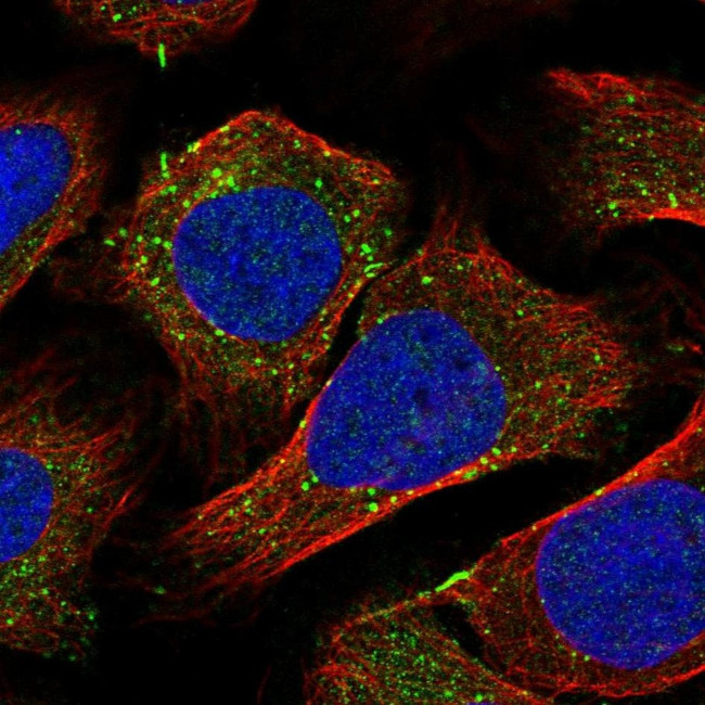 Rabenosyn 5 Antibody in Immunocytochemistry (ICC/IF)