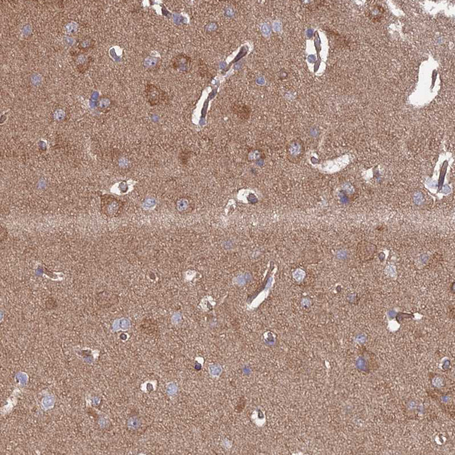 IA-6 Antibody in Immunohistochemistry (Paraffin) (IHC (P))