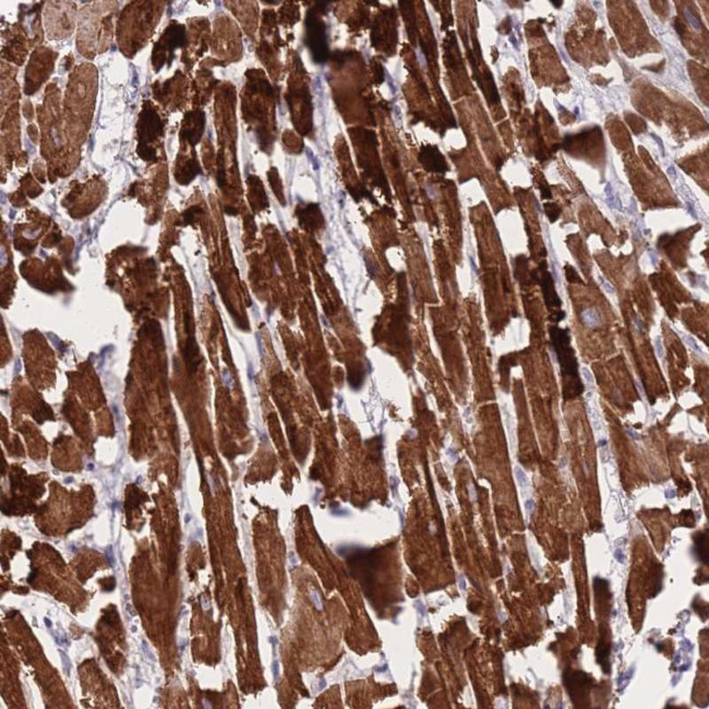 CtBP2 Antibody in Immunohistochemistry (Paraffin) (IHC (P))