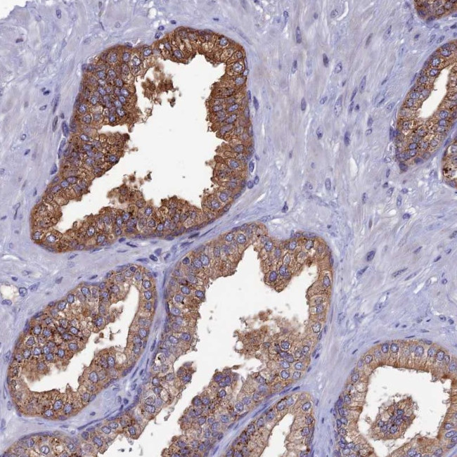 TOMM20L Antibody in Immunohistochemistry (Paraffin) (IHC (P))